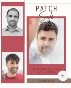 Tricologia e tricoprotesi uomo 4